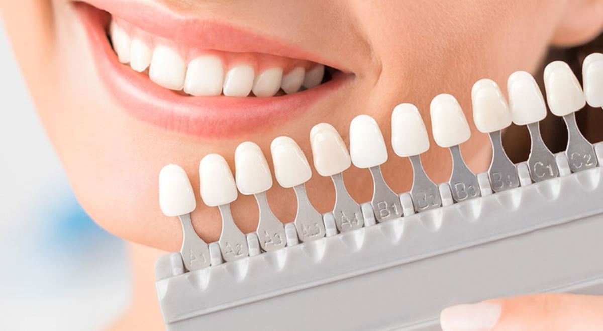 EMAX LAMİNE ( YAPRAK PORSELEN )